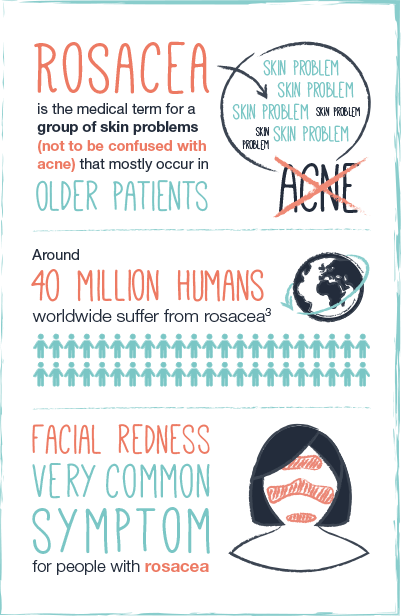Infographic